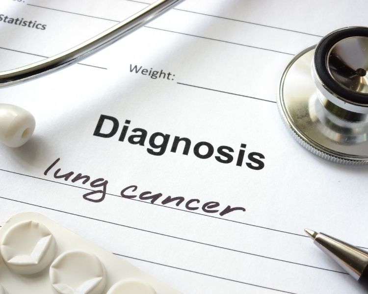 Lung cancer diagnosis
